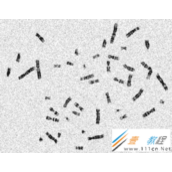 Python实现数字图像处理染色体计数代码示例