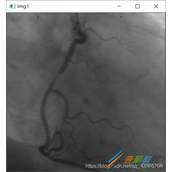 Python opencv医学处理实现代码示例