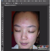 PS快速去除脸上痘印教程