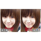 美图秀秀去除黑眼圈方法  怎么去除黑眼圈