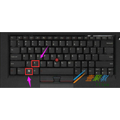 win8本地连接受限解决