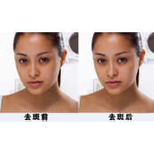 ps修补工具怎么快速处理人像面部斑点?