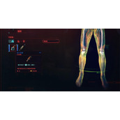 《赛博朋克2077》新手义体推荐