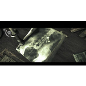 《恶灵附身》取出肚子里钥匙方法