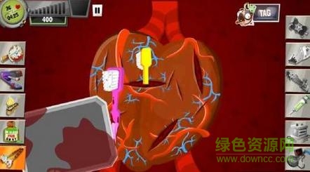 疯狂外科医生3内购修改版(surgeon3)