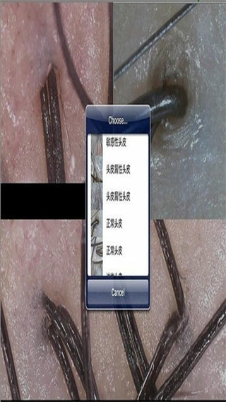 mrkv智能头皮皮肤检测