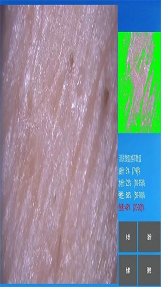 mrkv智能头皮皮肤检测