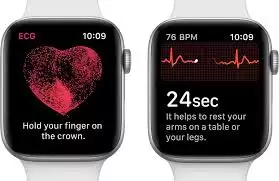 Apple Watch如何查看心电图